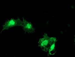 EIF5A2 Antibody (clone OTI6G7)