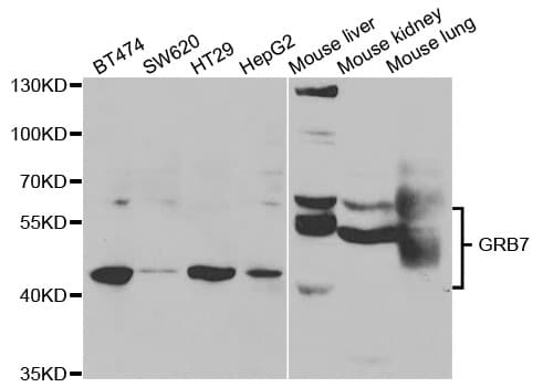 GRB7 Antibody (aa1-140)
