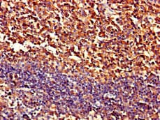 PIPOX / Sarcosine Oxidase Antibody