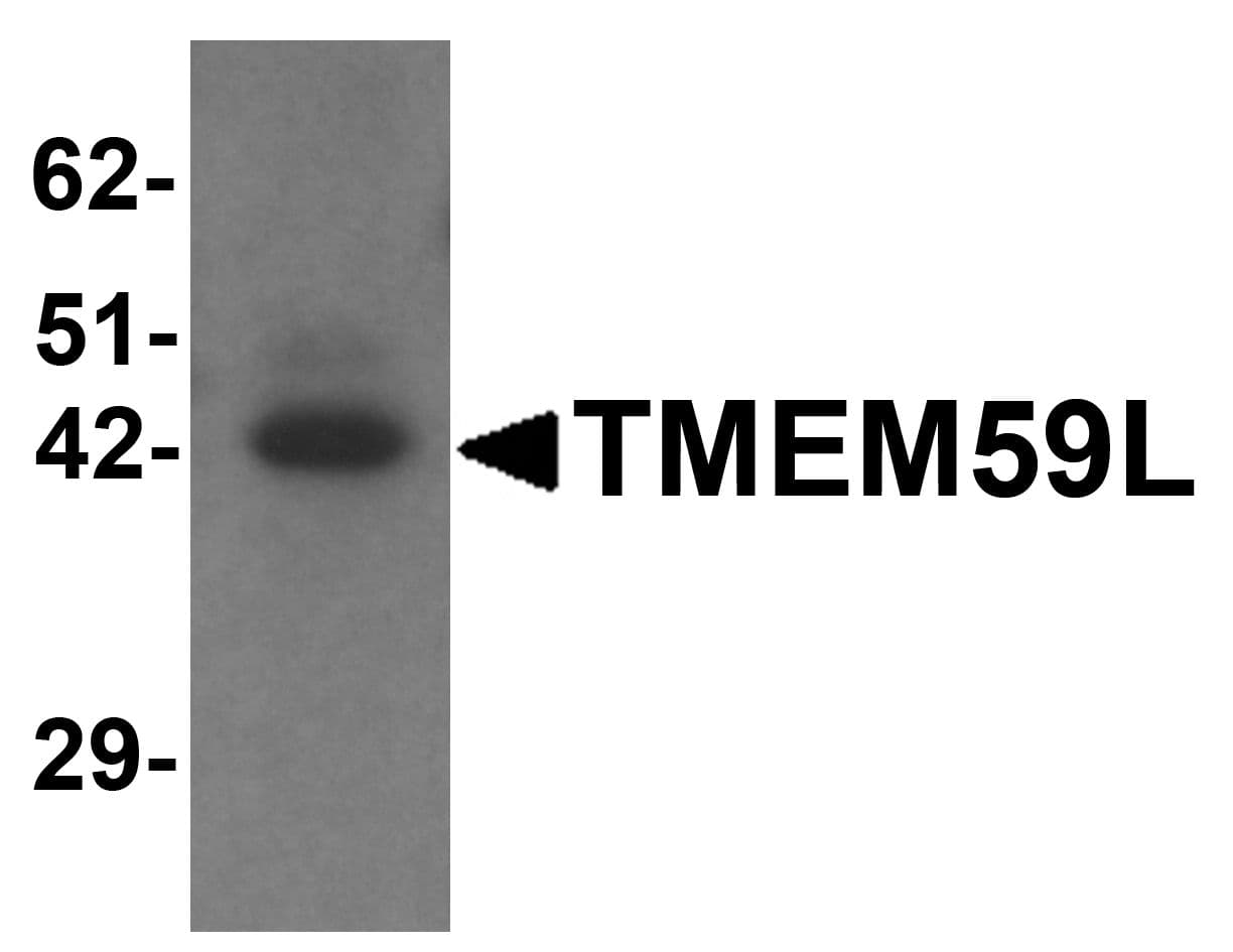 IHC-plus™ TMEM59L Antibody