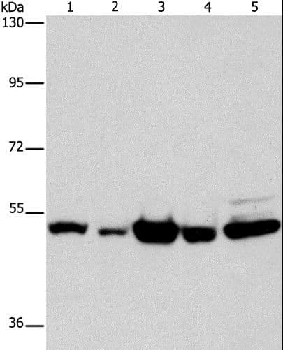Polyclonal Rabbit anti-Human PDE4D Antibody (IHC, WB)