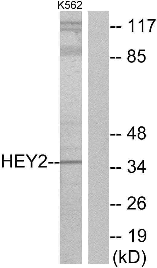 Polyclonal Rabbit anti-Human CHF1 / HEY2 Antibody (WB)