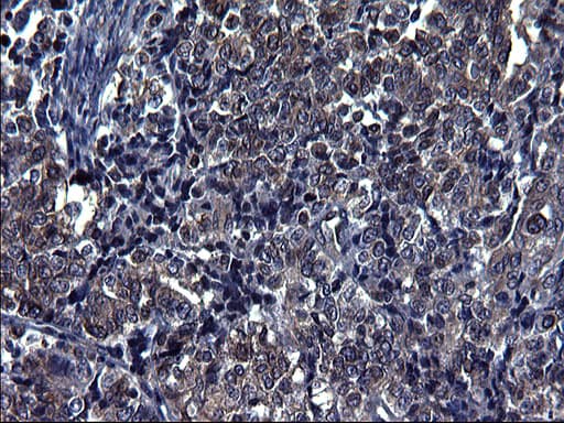 TUBA1A / Tubulin Alpha 1a Antibody (clone OTI2C8)