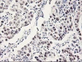 RBBP7 / RbAp46 Antibody (clone OTI4C9)