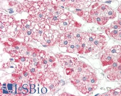 IHC-plus™ Polyclonal Rabbit anti-Human ELAVL4 / HuD Antibody (IHC, IF, WB)