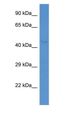 Polyclonal Rabbit anti-Human INPP5K / SKIP Antibody (aa23-72, WB)