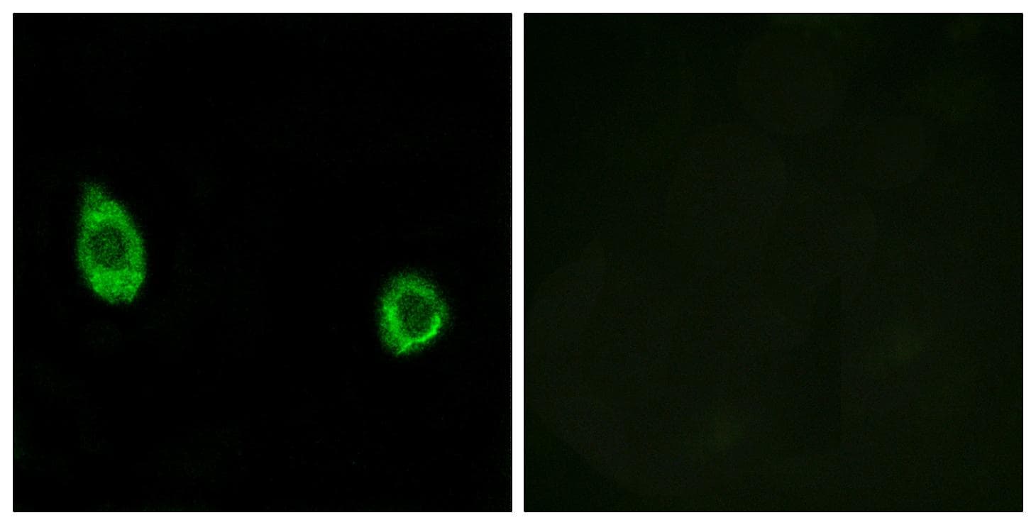 Polyclonal Rabbit anti-Human GALNAC4ST-2 / CHST9 Antibody (IHC, IF)