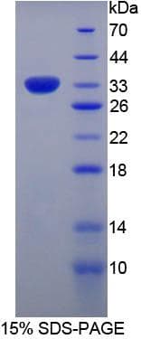 Human SPON1 / F-Spondin Protein (Recombinant His)