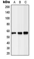 IHC-plus™ Polyclonal Rabbit anti-Human LIPC / Hepatic Lipase Antibody (Internal, IHC, WB)