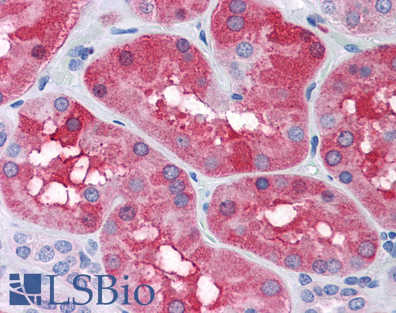 PathPlus™ FTL / Ferritin Light Chain Antibody (aa150-200)