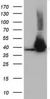 HIBCH Antibody (clone OTI4G1)