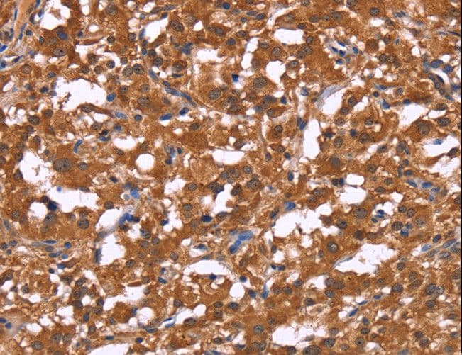 SMARCA3 / HLTF Antibody