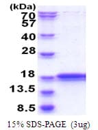 Human IMMP2L Protein (Recombinant His)