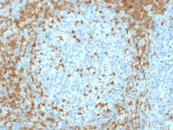 ZAP70 Antibody (clone ZAP70/2035)