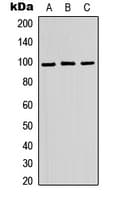 Polyclonal Rabbit anti-Human ATP6V0A2 Antibody (Internal, WB)