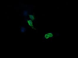 MAP2K3 / MEK3 / MKK3 Antibody (clone OTI6B11, Carrier-free)