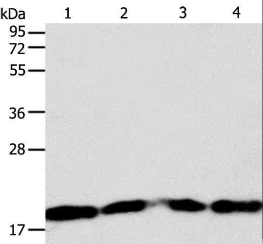 Polyclonal Rabbit anti-Human DIABLO / SMAC Antibody (IHC, WB)