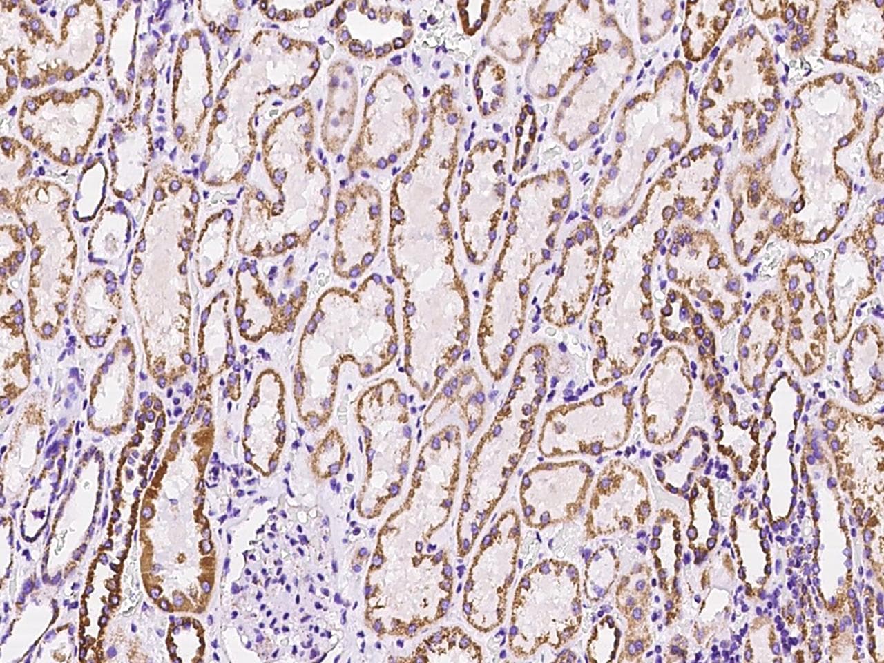 Polyclonal Rabbit anti-Human MRPL12 Antibody (IHC, IF, WB)