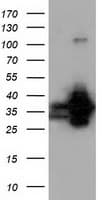 QPRT Antibody (clone OTI1C10, Carrier-free)