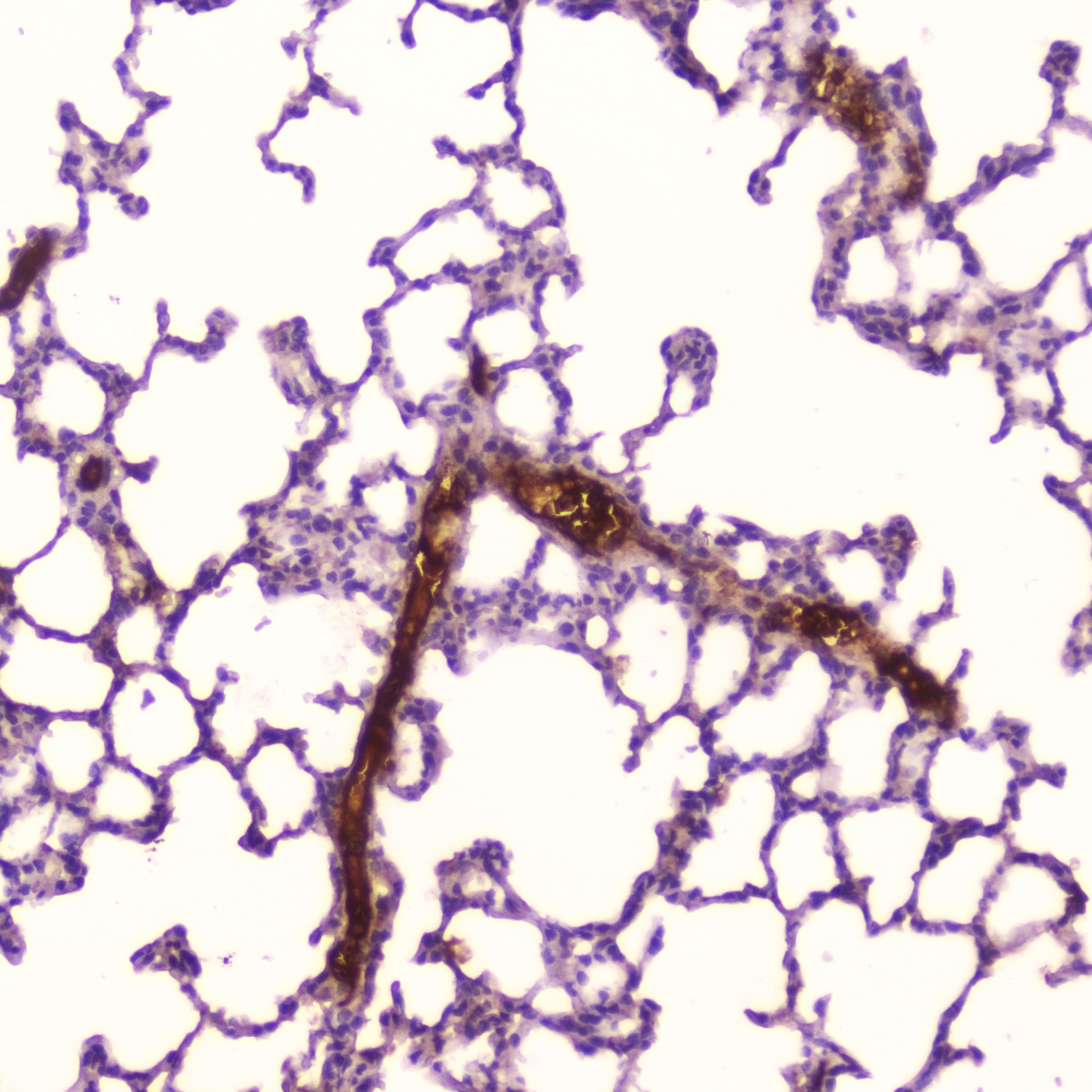Polyclonal Rabbit anti-Rat CRP / C-Reactive Protein Antibody (IHC, WB)