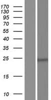 HAUS2 Protein (Over-Expression Lysate Myc-DDK (Flag))