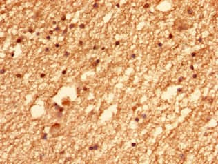 Polyclonal Rabbit anti-Human KIAA1377 Antibody (WB)