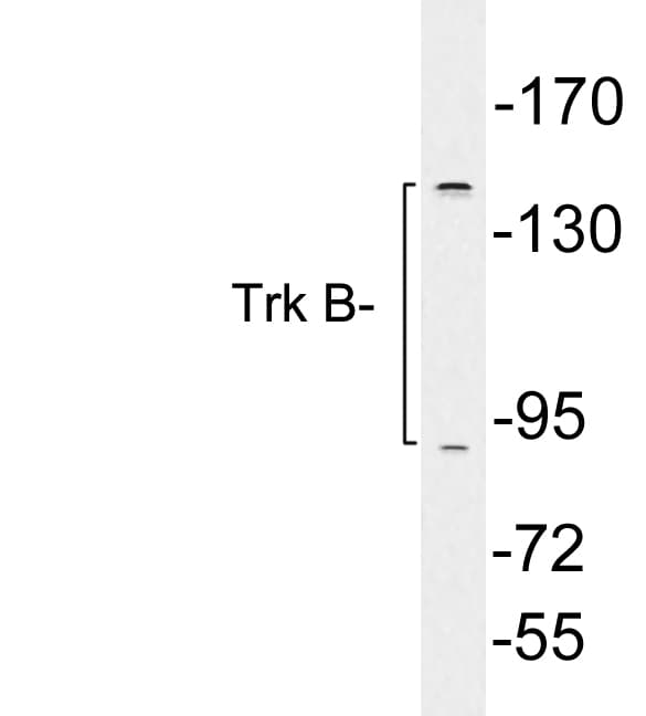 Polyclonal Rabbit anti-Human NTRK2 / TRKB Antibody (aa768-817, WB)