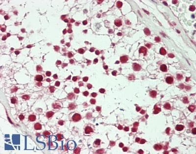 IHC-plus™ Polyclonal Rabbit anti-Human CTNNBL1 / NAP Antibody (aa1-50, IHC)