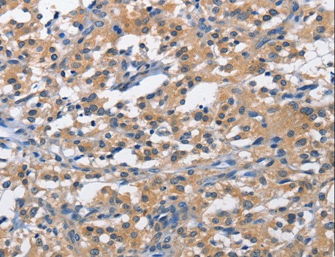 PIM1 / Pim-1 Antibody