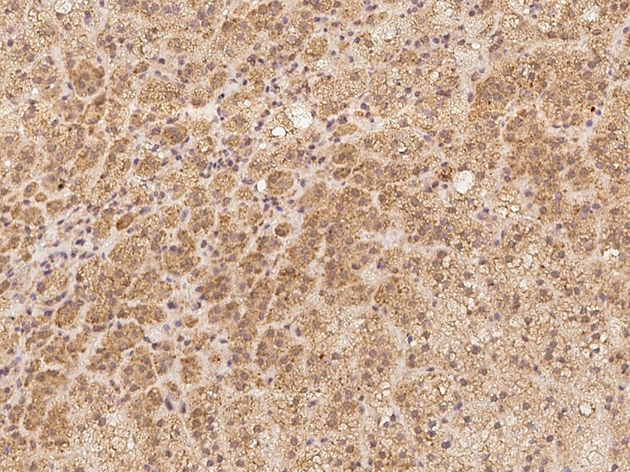 ARHGEF9 / Collybistin Antibody