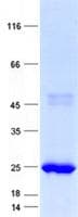 Human FGF16 Protein (Recombinant His, N-Terminal)