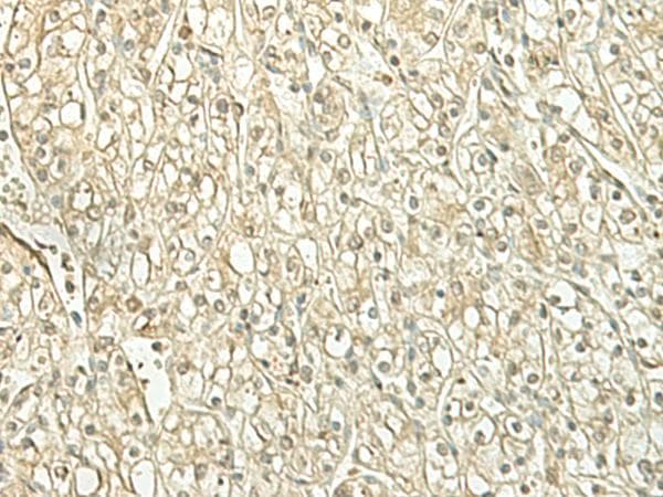 SPIRE1 Antibody