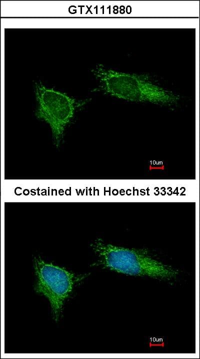 NDUFB5 Antibody (aa126-189)