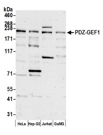 IHC-plus™ RAPGEF2 Antibody (aa975-1025)