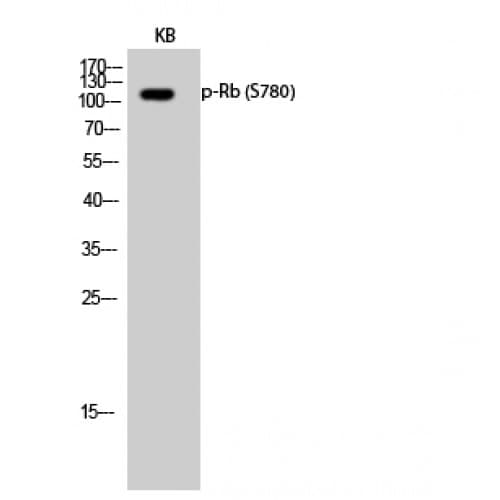 RB1 / Retinoblastoma / RB Antibody (720-800 aa)
