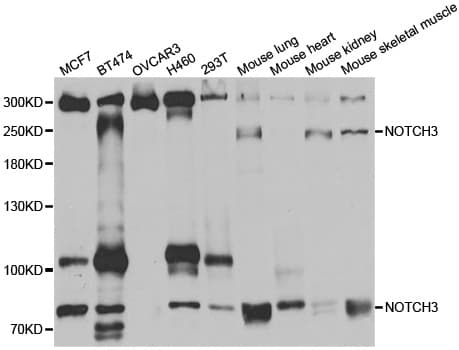 IHC-plus™ Polyclonal Rabbit anti-Human NOTCH3 Antibody (IHC, IF, WB)