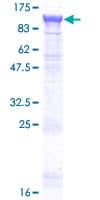Human NCSTN / Nicastrin Protein (Recombinant GST)