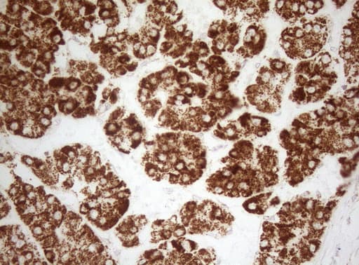 DECR1 Antibody (clone OTI8F11)