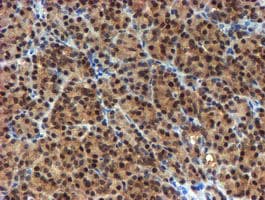 NQO2 Antibody (clone OTI1G2)