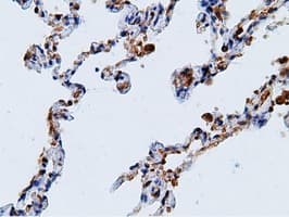 KHK / Ketohexokinase Antibody (clone OTI3D1)
