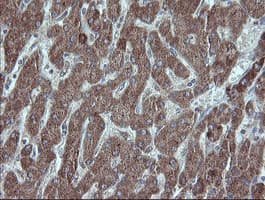 Monoclonal Mouse anti-Human UBE2J1 Antibody (clone OTI3C11, IHC, WB)