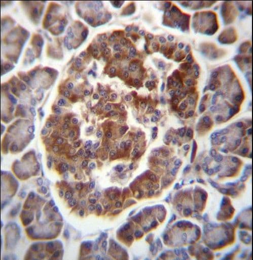 TBC1D22A Antibody (aa447-476)