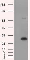 NIT1 Antibody (clone OTI3A11)