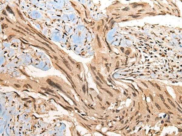 CBFB Antibody