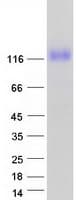 Human PSK / SEZ6L2 Protein (Recombinant Myc-DDK (Flag))