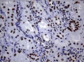 NBN / Nibrin Antibody (clone OTI1F11)