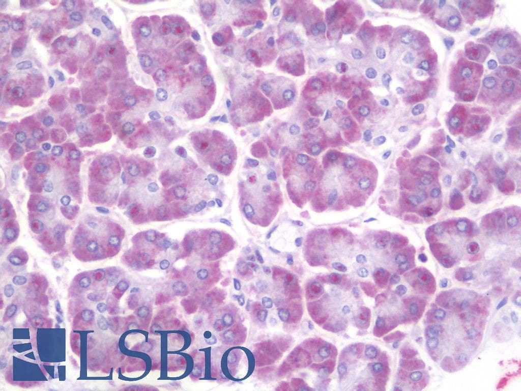 IHC-plus™ Ceramide Kinase / CERK Antibody (aa487-516)