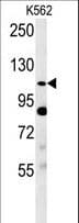 SEMA5A / Semaphorin 5A Antibody (Ser106)