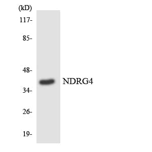 Polyclonal Rabbit anti-Human NDRG4 Antibody (aa168-217, IHC, WB)
