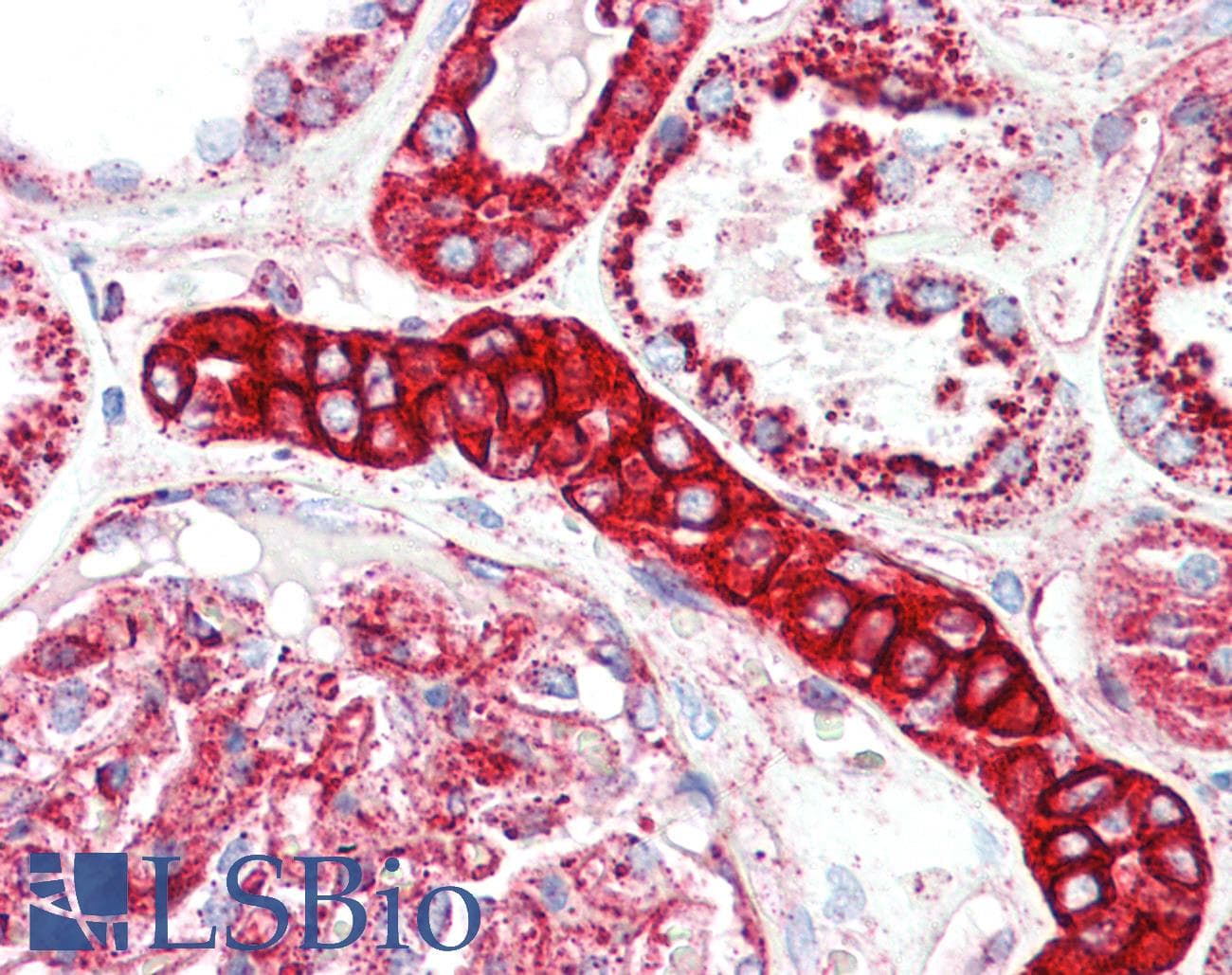 IHC-plus™ Polyclonal Rabbit anti-Human LAMP1 / CD107a Antibody (aa125-154, IHC, WB)